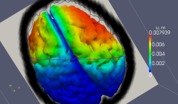 Simulated brain deformation
