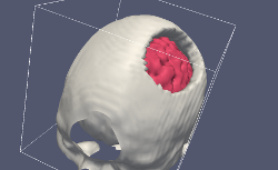 Skull with an opening